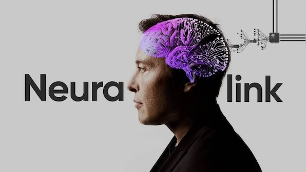 Neurolink чипи ёрдамида тил ўрганаётган бемор